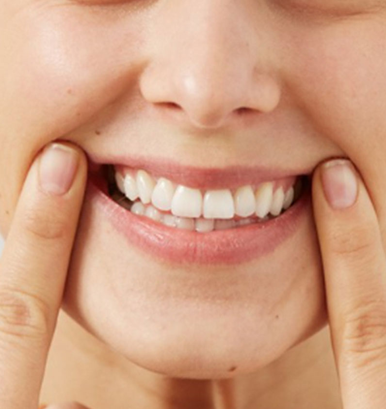 Gülüş Estetiği (Gülüş Tasarımı) ve Hollywood Smile